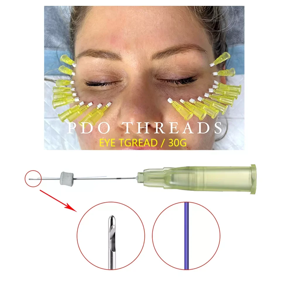 

20 шт. ПДО нитки Blunt W Cannula Hilos удаление мешка для глаз морщины вороны лифтинг лица PCL PLLA провода