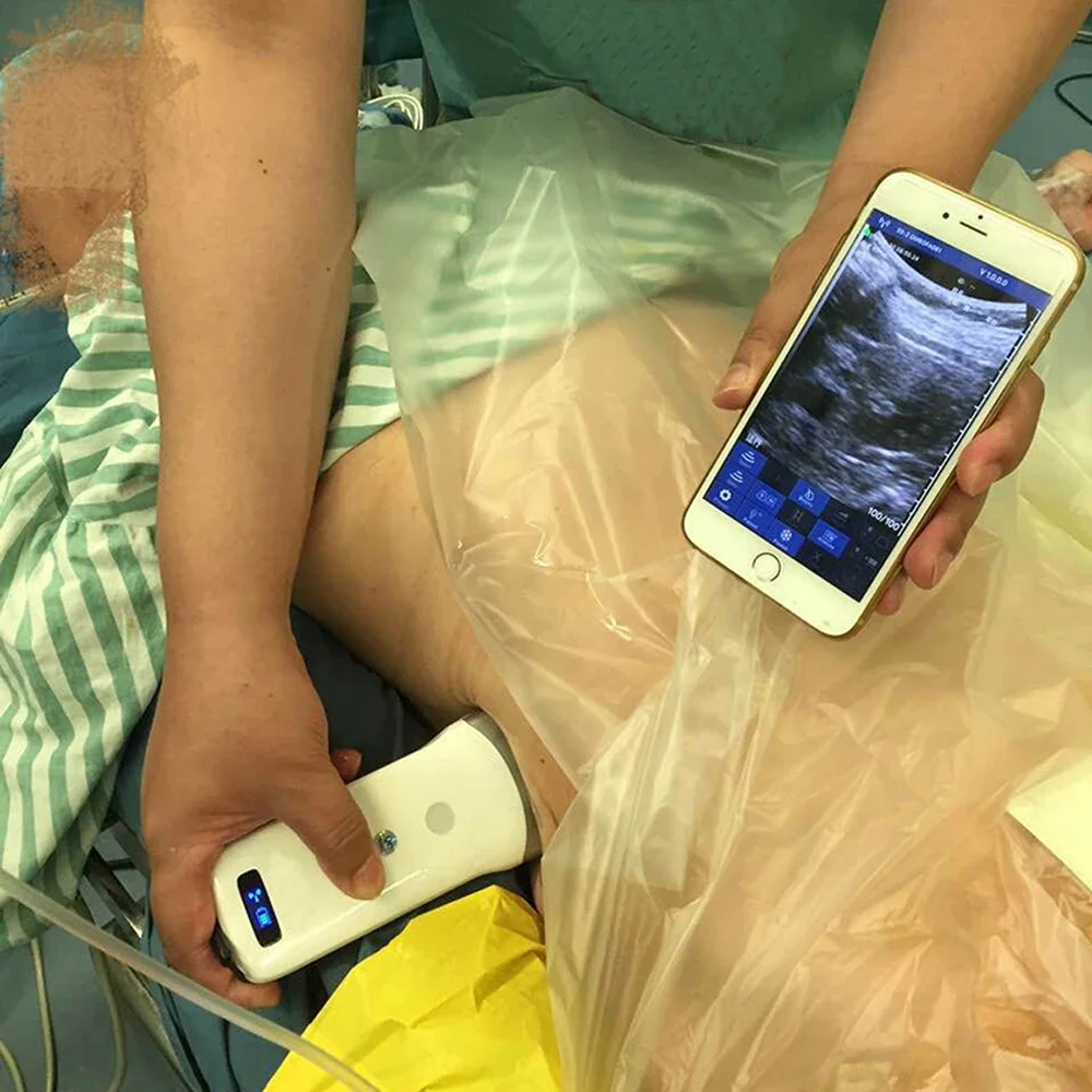 Беспроводной ультразвуковой сканер 80E выпуклый зонд 3 2 МГц с поддержкой IOS Android