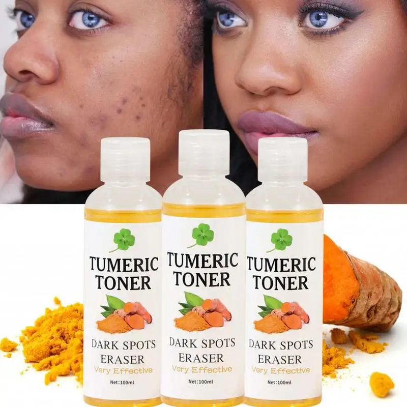 

100ml Turmeric Face Toner Effective Dark Spot Remover Facial Essence Non-Greasy Skin Hydrating Serum For Smooth Shining Skin