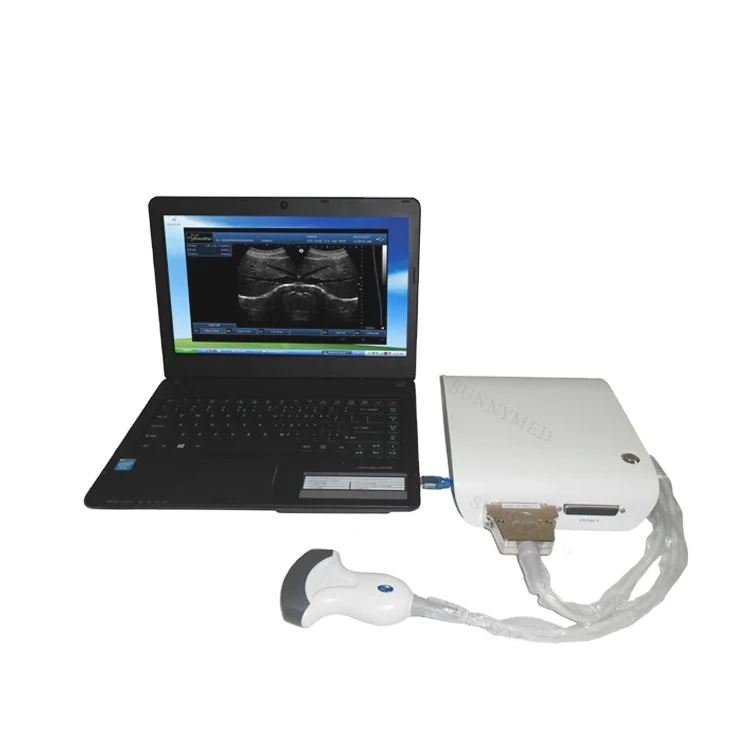 

SY-A010 Human or animal 3D B/W Eye Equipment Ultrasound Box Scanner Medical Ophthalmic B Scan Ultrasound Machine