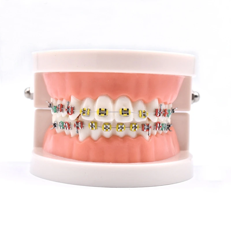 

1 Pcs Orthodontic Treatment Model With Ortho Metal Ceramic Bracket Arch Wire Buccal Tube Ligature Ties