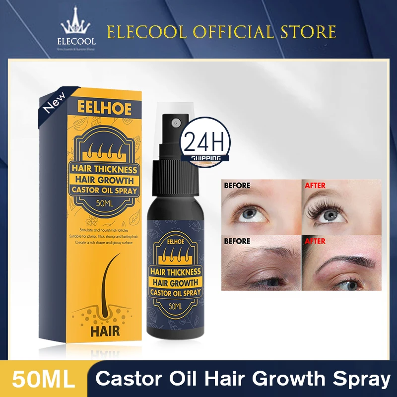 

Hair Growth Spray Castor Oil Nourish Hair Fast Growth Oil Repair Hair Loss Thinning Hair Product Hair Care To Reduce Hair Loss