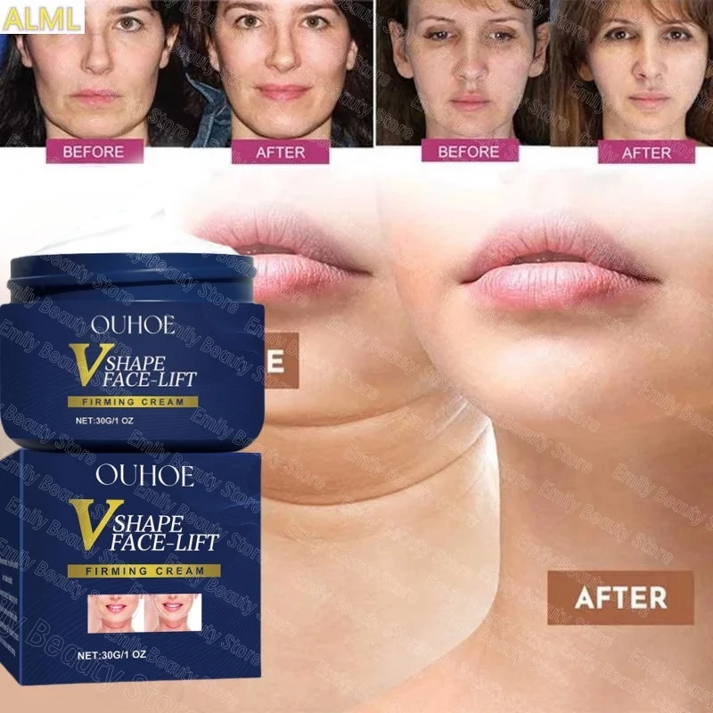 V-образный укрепляющий крем для подтяжки лица похудения удаление жевательных