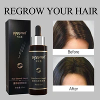 hair growth essential oil for menwomen anti hair loss serum healthy safe hair care treatments effective hair regrowth product