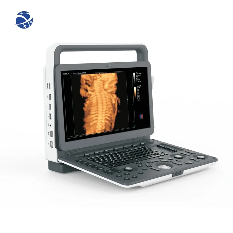 Портативный 2d 3d 4d эхокардиографический портативный цветной допплер-сканер для