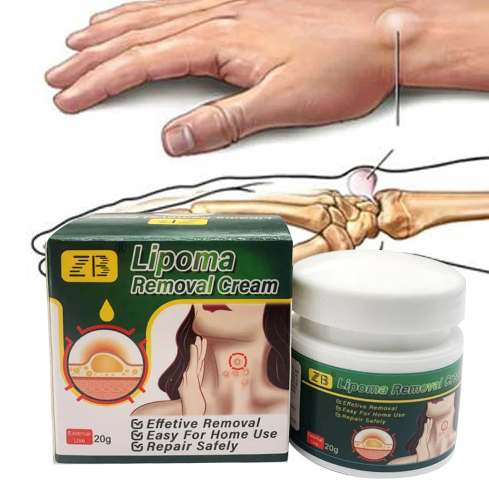 

Newly Lipoma Removal Cream Natural Herbal Cream Safely Repair Lipoma Inflamation 20g Fatty Tumor Removal Cream