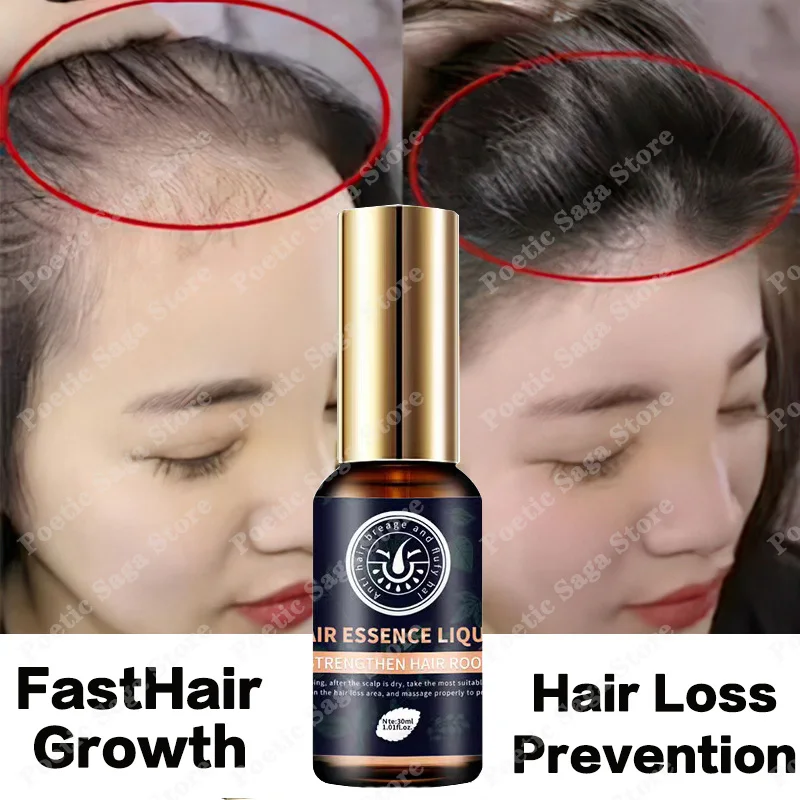

Масло для роста волос для мужчин и женщин, имбирное средство против выпадения волос, средство для утолщения кожи головы, продукты для роста волос