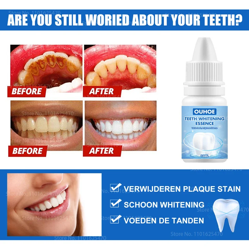

Pemutih Gigi Remover Teeth Whitening White Teeth Whitening Teeth Whitening Gigi Tooth Whitening Plaque Remover OUHOE