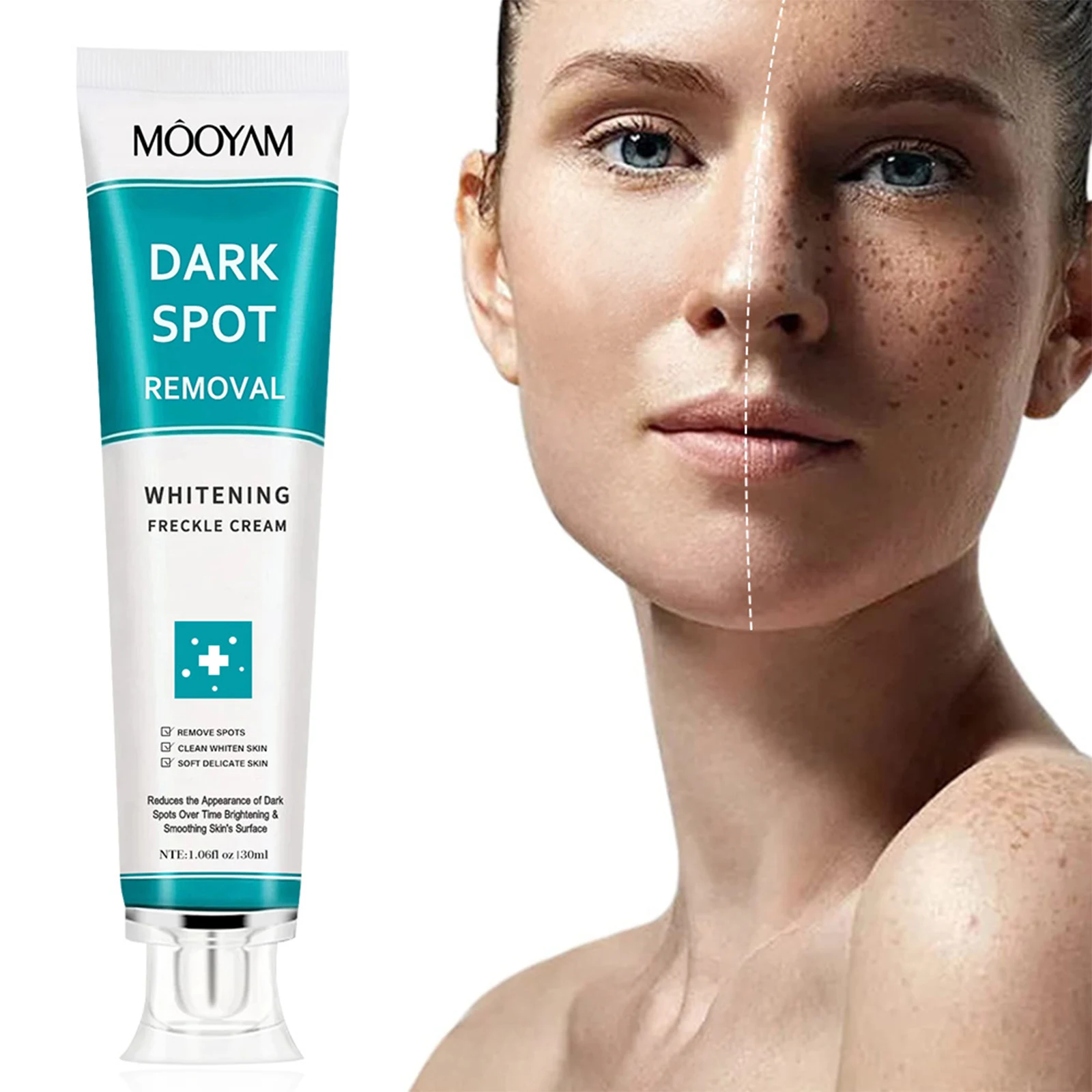 

Whitening Cream Face Freckle Remove Dark Spots Fade Acne Scars Melanin Pigmentation Melasma Anti-Aging Brighten Skin Face Creams