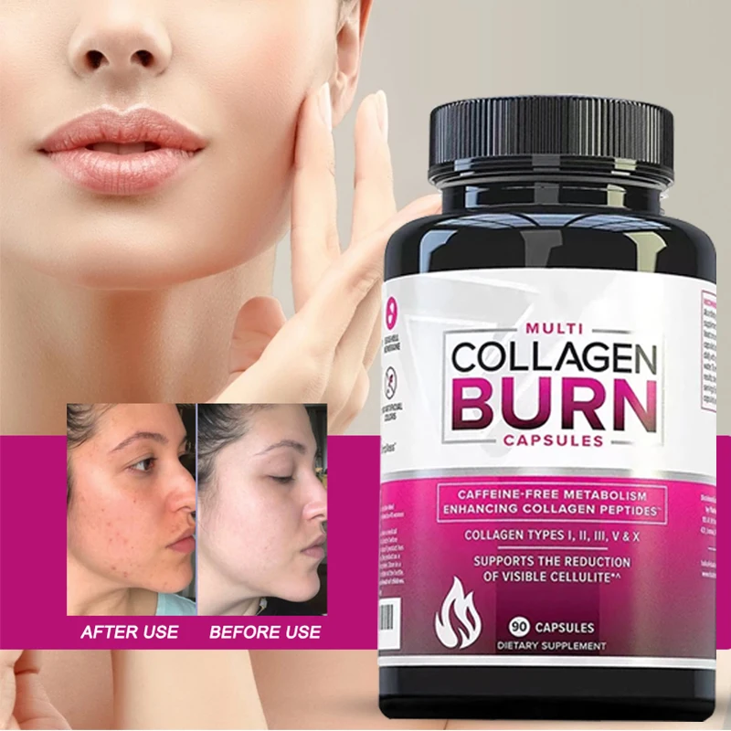 

1 Bottle Collagen Peptide Capsules Eliminate Fat Masses Wrinkles Support Anti Aging Hair Skin Skeleton Health supplement