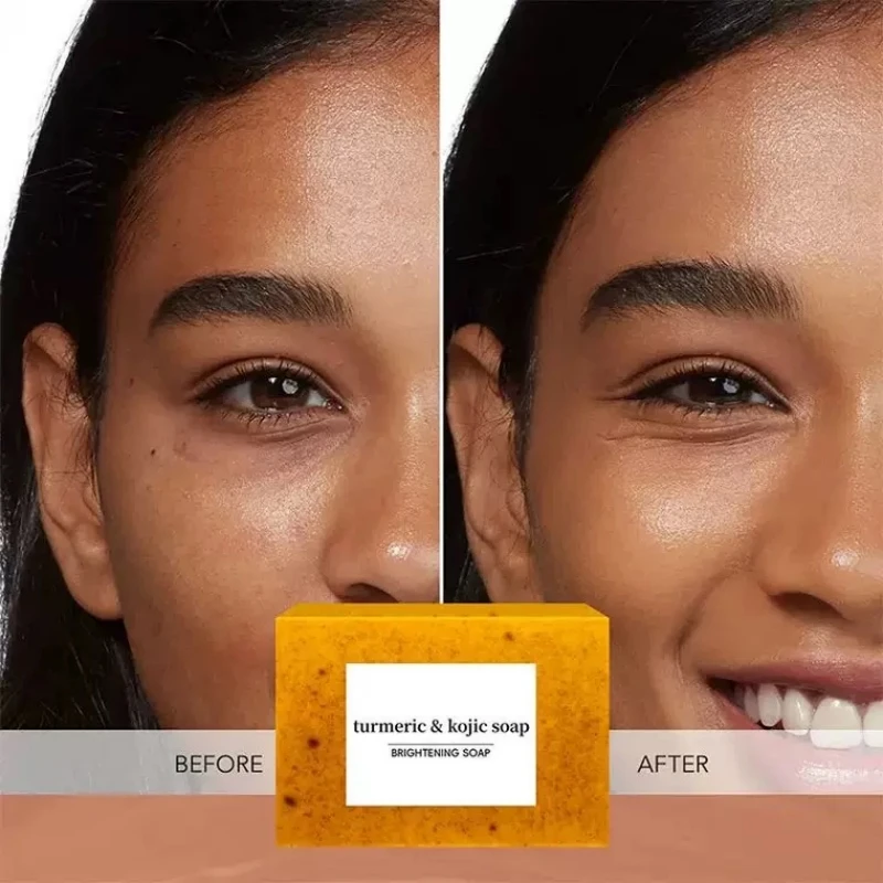 Мыло с куркумой и койевой кислотой 100 г