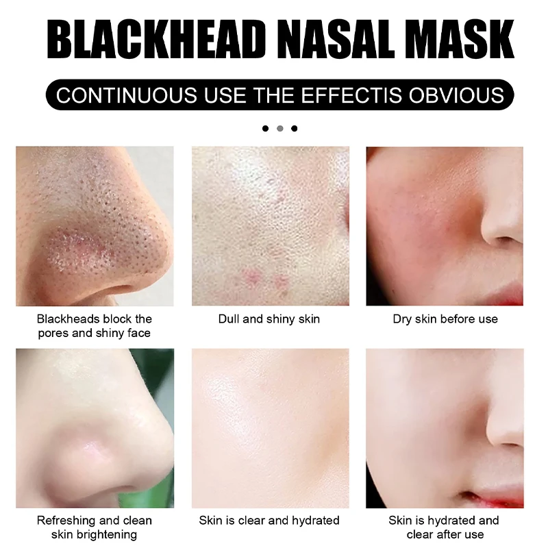 Рисунок 3 - сыворотка для удаления черных точек