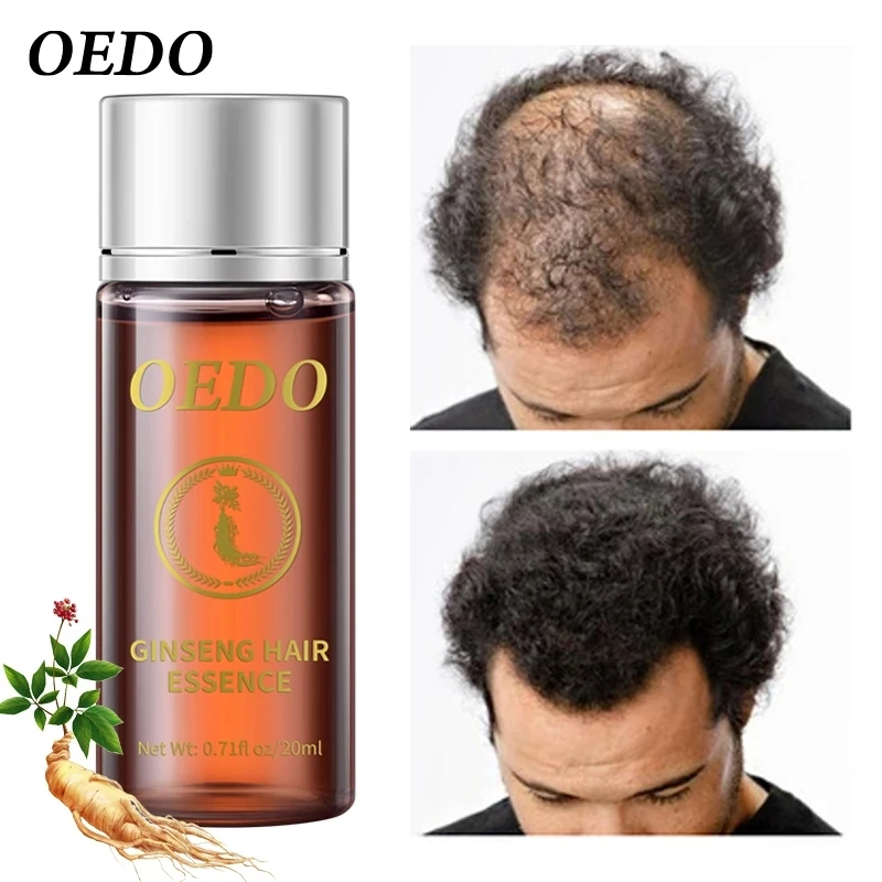 

20ML Ginseng Hair Growth Essence Preventing Hair Loss Liquid Damage Hair Repair Treatment Dense Fast Restoration Hair Growth