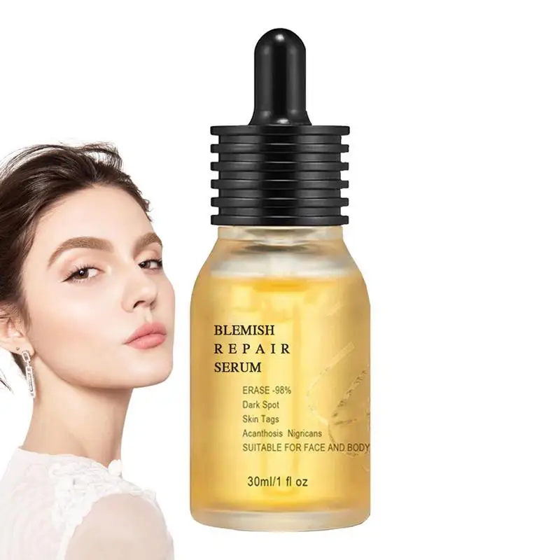 

Facial Lightening Serums 30ml Facial Blemish Toner Lighten Dark Spots And Pigmentation Dry Skin Rejuvenates Lightening Essence