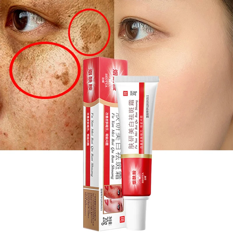 

20g Whitening Freckle Cream Niacinamide Remove Melasma Dark Spots Melanin Corrector Moisturizer Brighten Face Skin Care Products