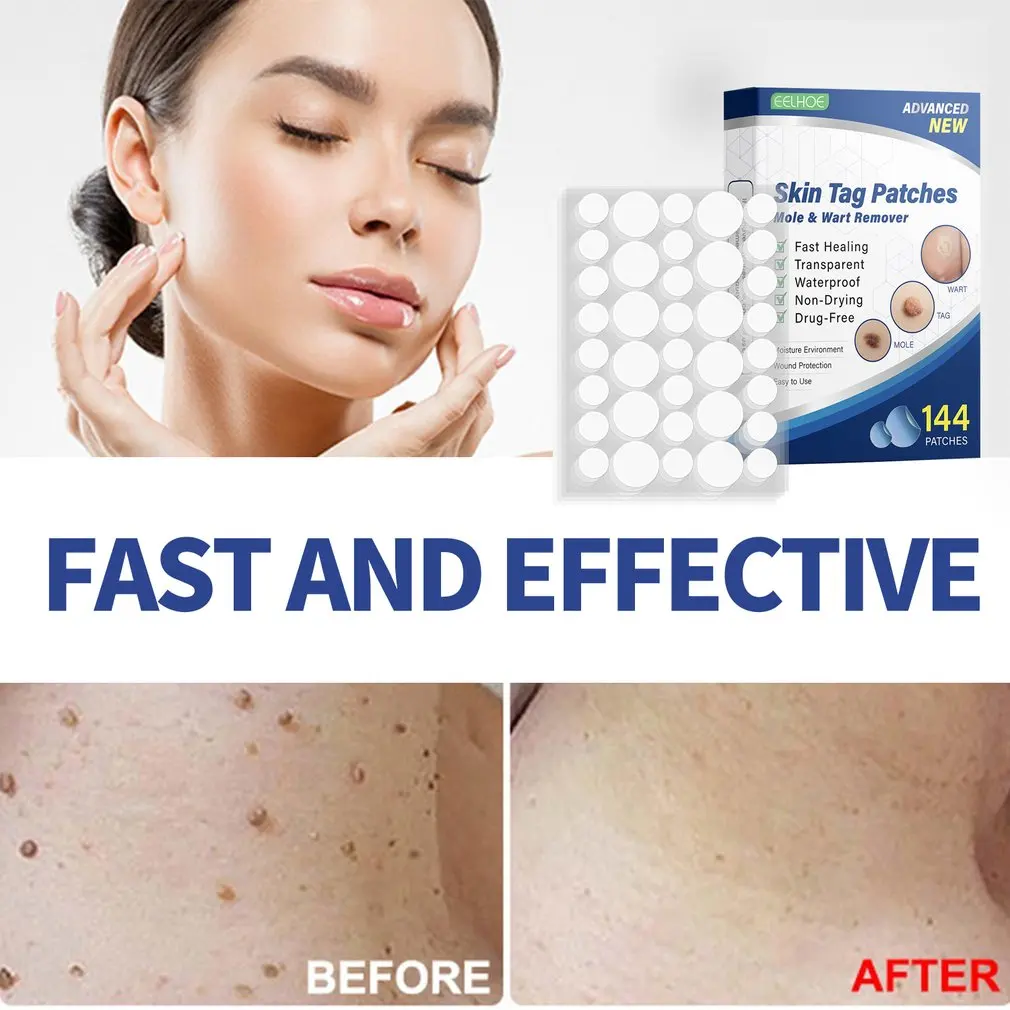 

144pcs Wart Removal Patches Skin Tag Remover Treatment Facial Wart Spots Painless Antibacterial Sticker Invisible Skin Care
