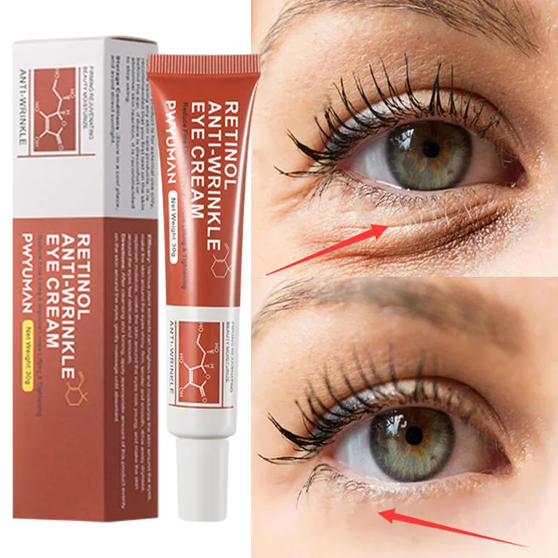 

Retinol Remove Wrinkles Eye Cream Anti Dark Circles Fade Fine Lines Eye Bags Anti Puffiness Brighten Firming Care Beauty Health