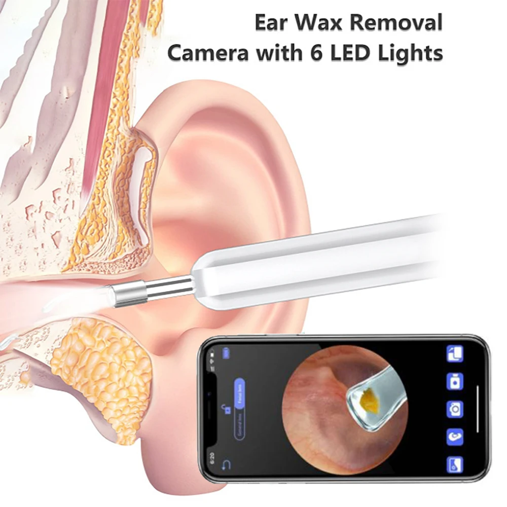 

Smart Visual Earpick Led Luminous Ear Cleaner Wireless Ear Pick Stick Earwax Removal High Precision Ear Spoon Endoscope Otoscope