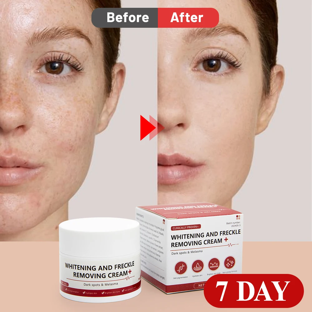 Отбеливающий и крем против веснушек удаляет темные пятна солнечные