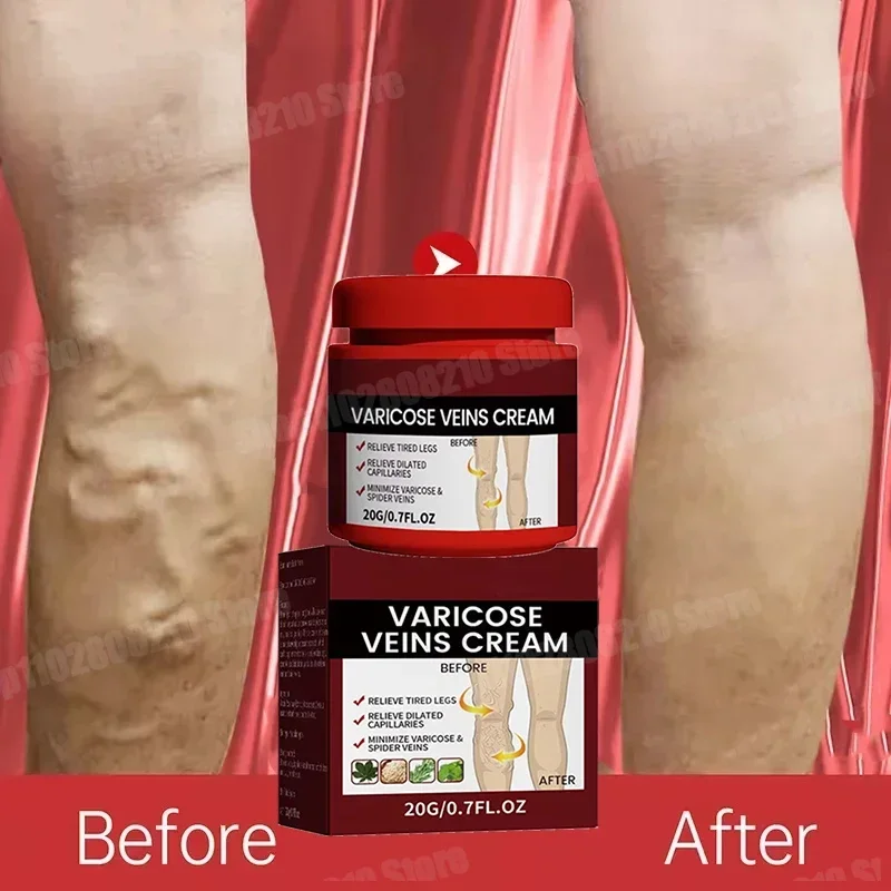 Псориаз дерматит экзема гадание грибка против зуда успокаивающий местный крем