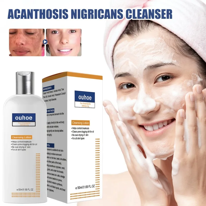 

Efficiently Cleansing Skin Cleanser Brighten Skin Tone Foam Facial Cream Spot-reducing Cleanser Black Acanthoderm Cleanser