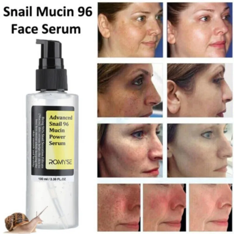 

Snail Anti Aging Serum Advanced Moisturizing Skin Care Sagging Firming Tightening Fade Fine Lines Collagen Booster Essences