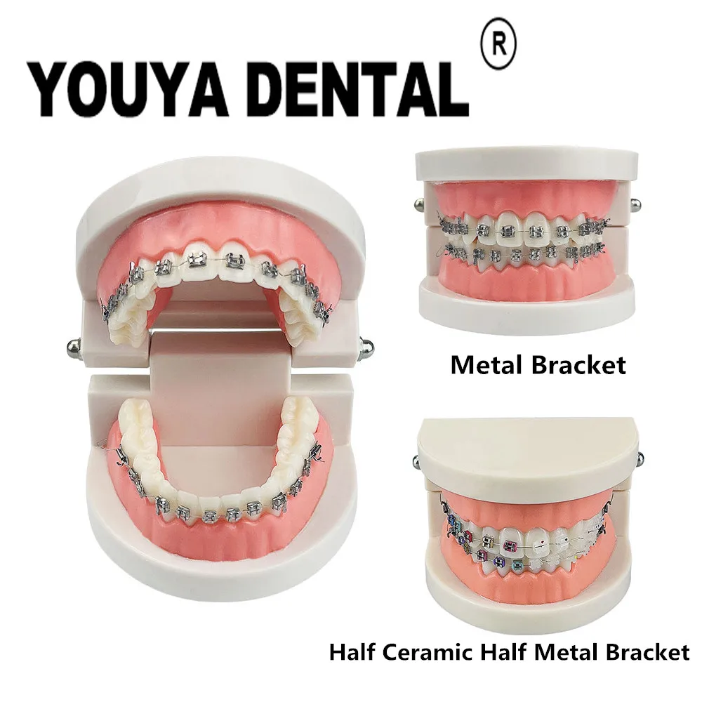 

Orthodontic Practice Model with Ceramic Metal Bracket for Dentist Technician Student Teaching Training Studying Dentistry Tools
