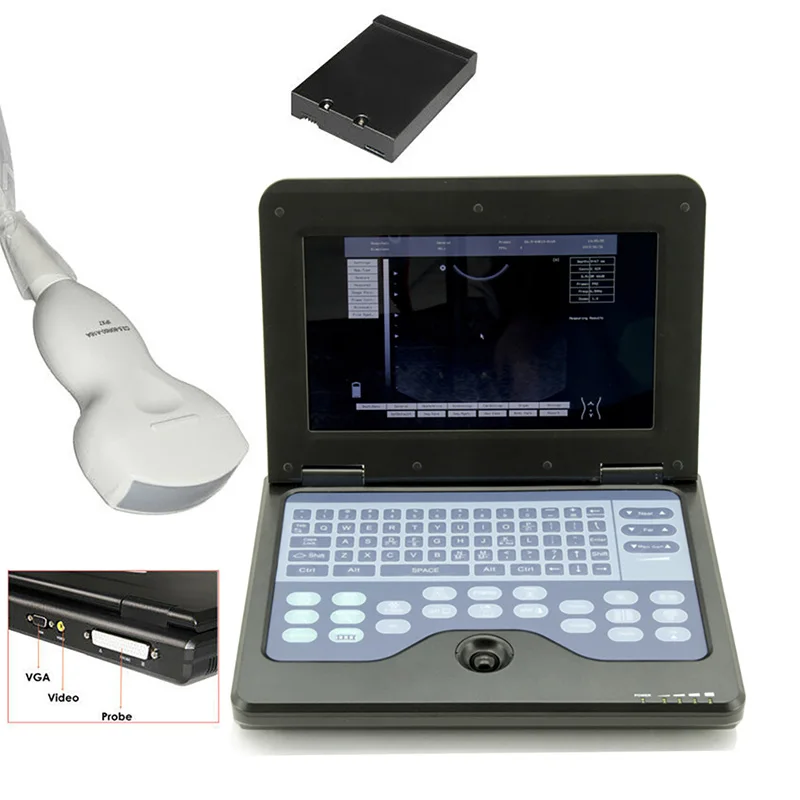 

Chinese manufacturer echo ultrasonography probe wireless transducer