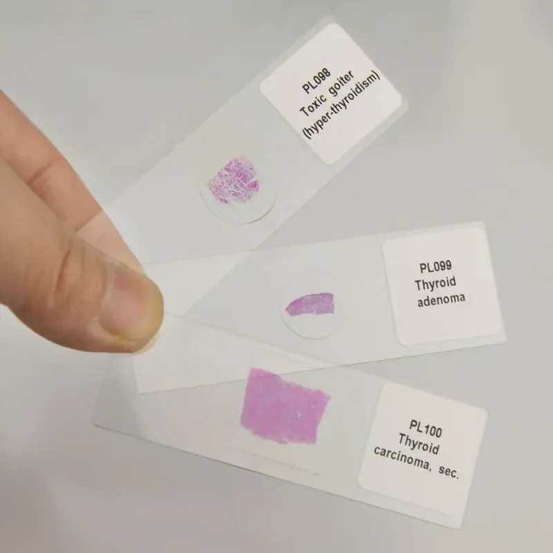 100 видов медицинских патологических секций человеческого тела типовые