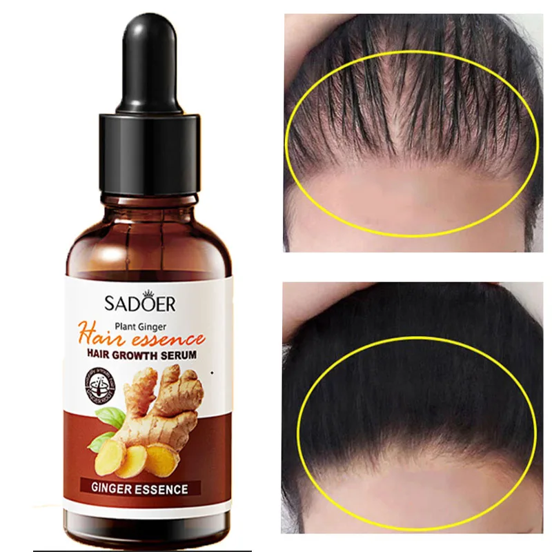 

Ginger Hair Growth Serum Fast Growing Hair Essential Oil Anti Hair Loss Prevent Hair Dry Thinning Scalp Repair Hair Care Product