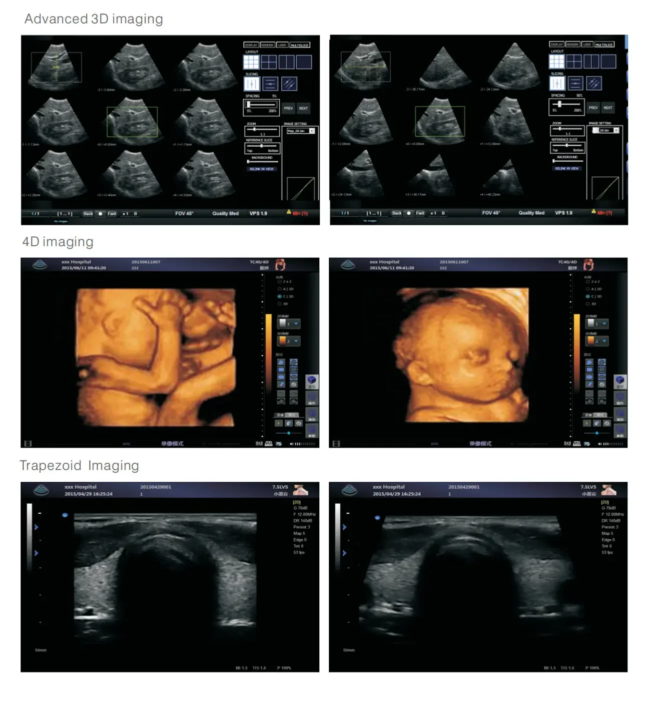 Рисунок 3 - Допплер Ветеринарный ультразвуковой