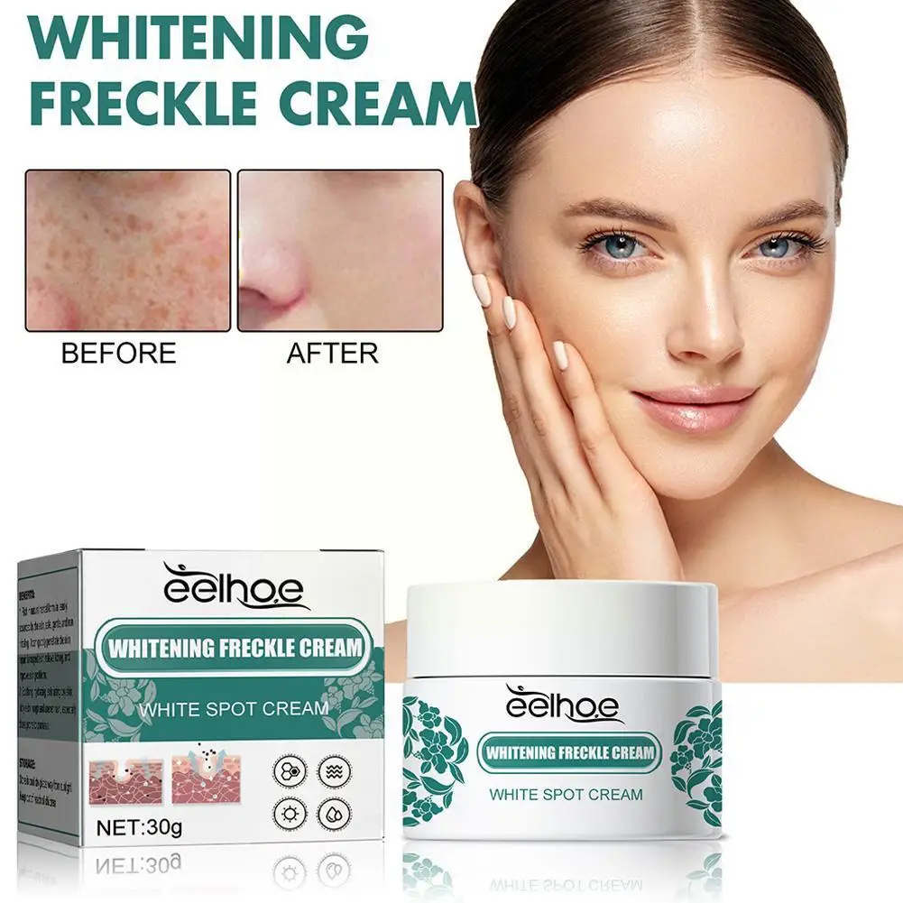 

30g Herbal Remove White Spot Anti-aging Cream Whiting Moisturizing Skin Cream Lightening Sunburn Face Freckle Stain U3G8