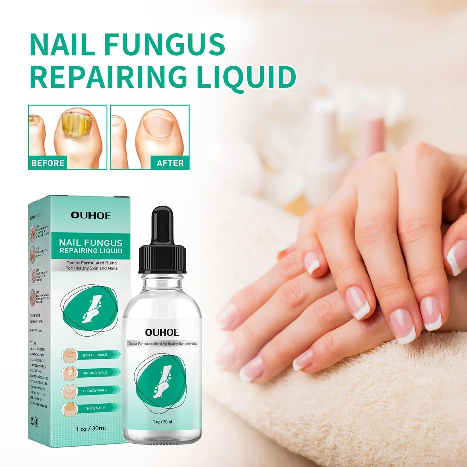 

Care Hand Foot Care Removal Repair Nail Fungus Treatment Feet Serum Infection Essence Gel Anti Anti Onychomycosis Infective L8S2