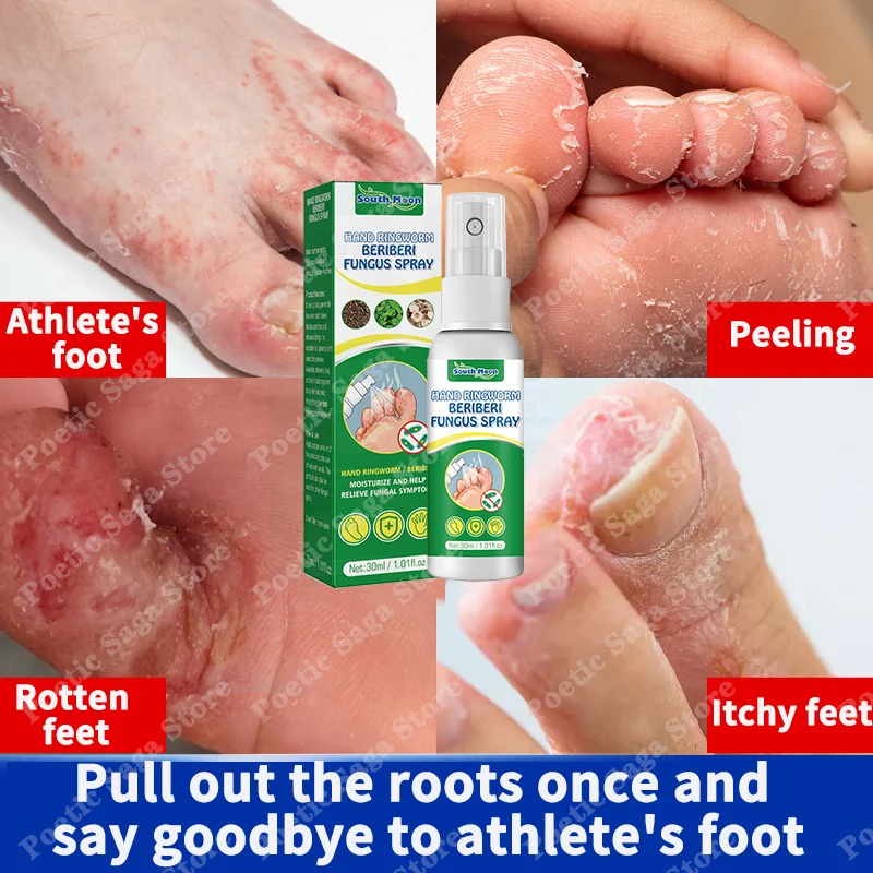 

Foot Treatment Cream Athlete's Foot Ointment Anti-Itching Inhibits Fungal Peeling Athletes
