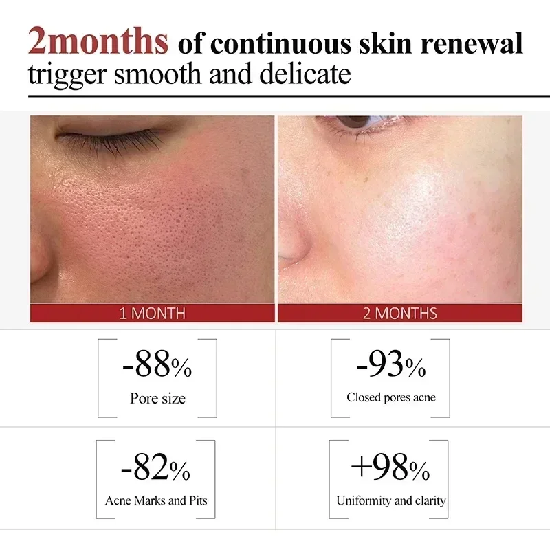 Сыворотка для сужения пор восстанавливает большие поры сыворотка лица с