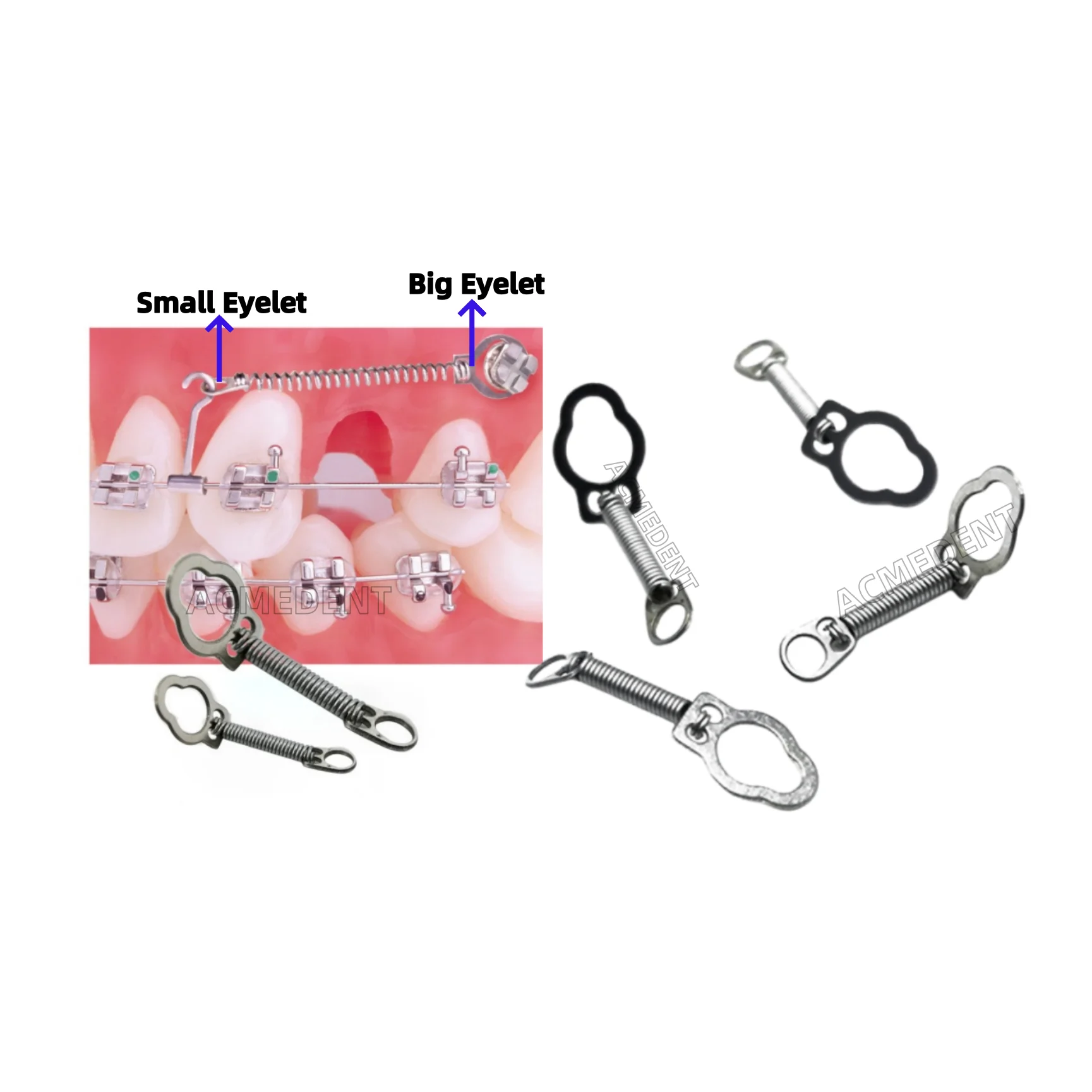 10 шт. стоматологические замкнутые спиральные пружины мини-винтовые имплантаты