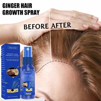 hair growth spray products anti hair loss essential oil fast growing treatment prevent hair thinning dry hair care for men women