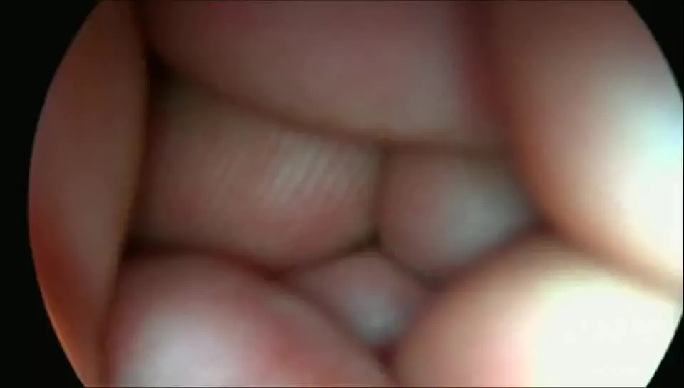 Высококачественные HD медицинские портативные USB-камеры эндоскоп цифровой