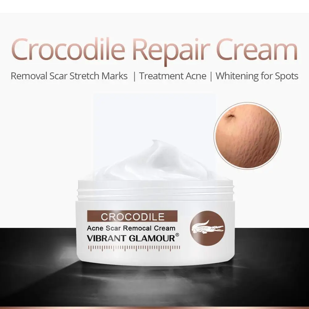 

Восстанавливающий Крем Z1j0, 30 г, от акне, шрамов, отбеливающий уход, Осветляющий тон, увлажняющий, сужает поры кожи