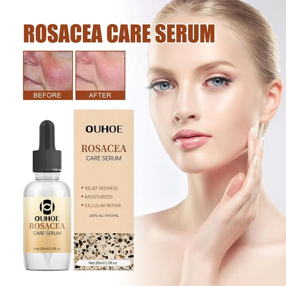 

30ml Rosacea Cure Serum Erythema Repair Essence Soothing The Skin Repair Facial Skin Moisturizing Care Serum And D3X5