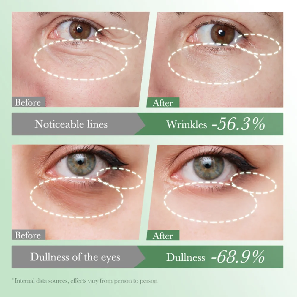 Крем для кожи вокруг глаз Centella от темных кругов и под глазами