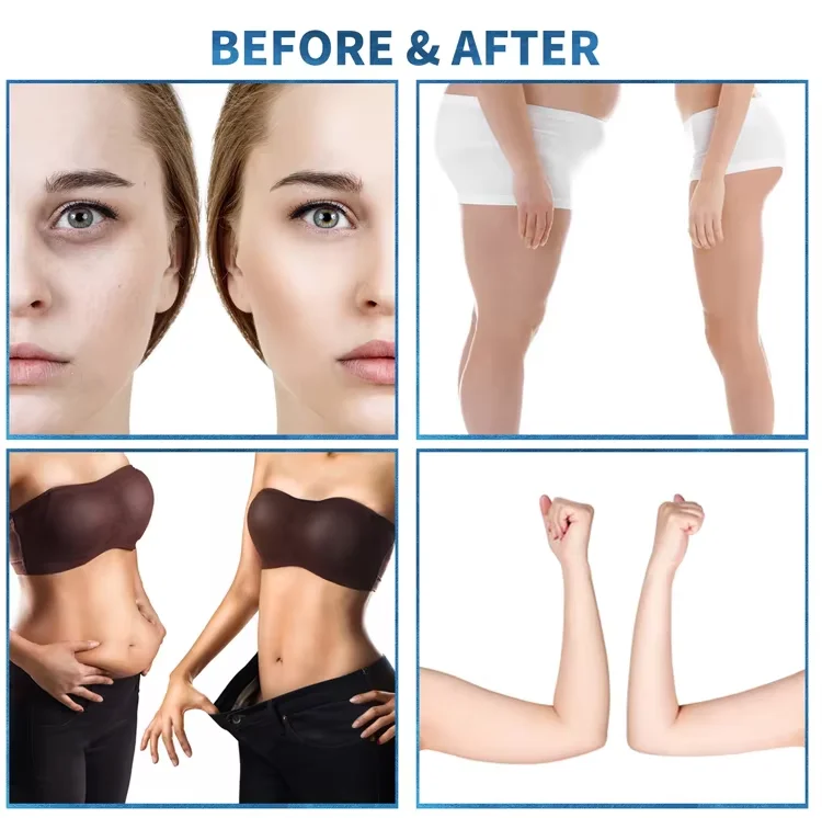 профессия уменьшение целлюлита внутренний шариковый ролик лимфатический массаж