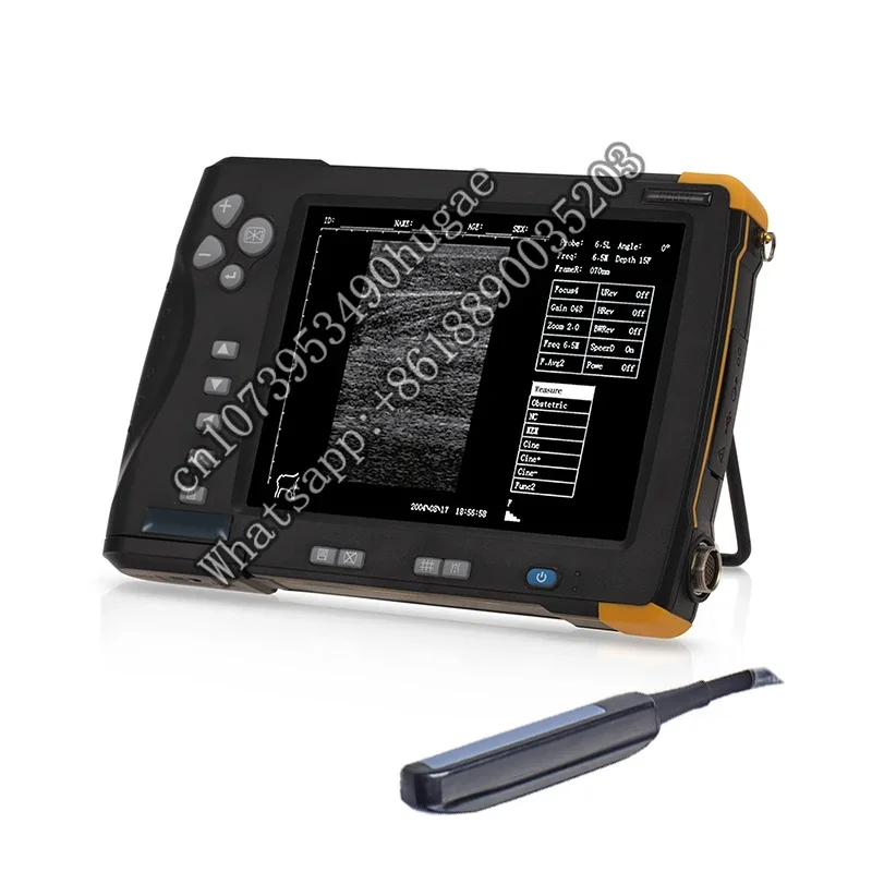 Ректальный выпуклый зонд 2-10 МГц 7-дюймовый экран портативный ультразвуковой