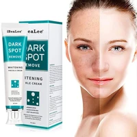 whitening freckle cream remove melasma cream remove dark spots melanin melasma remover brighten skin anti aging moisturizing 20g