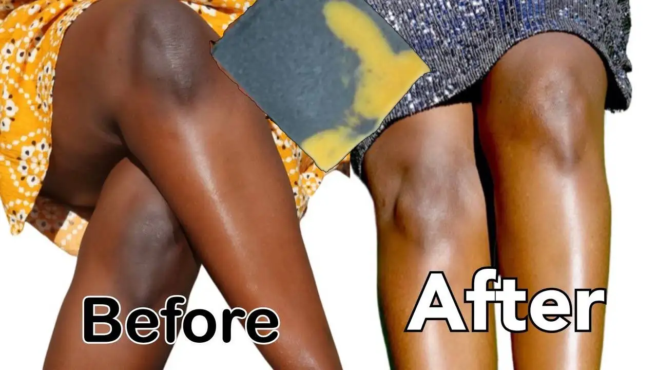 

Dark KNEES ELBOWS LIGHTENING Soap Private Parts Brighten Products Underarm Armpit Nipple Neck Lips Dark Spots Soap Kojic Acid