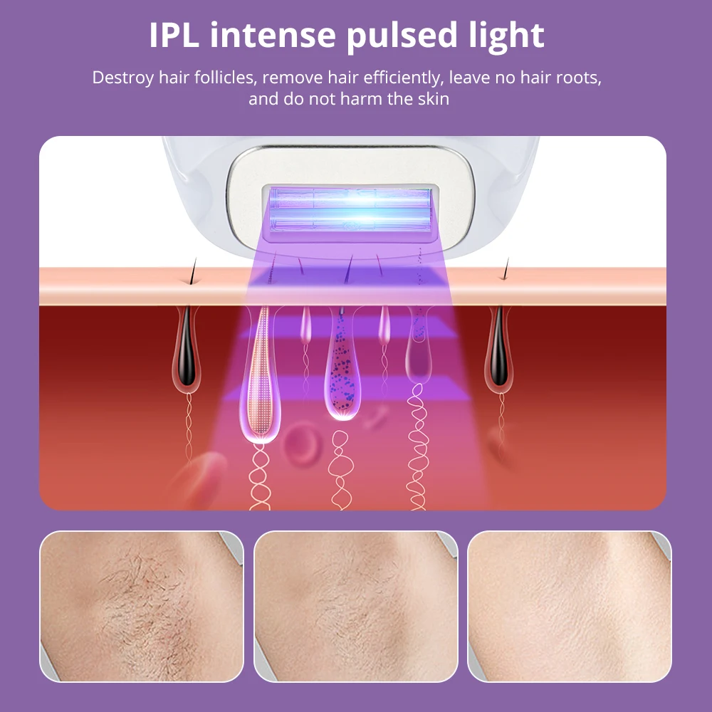 2023 New Laser Hair Removal Instrument Household Depilator Laser Epilator Permanent IPL Painless Photoepilator Bikini Face Body enlarge