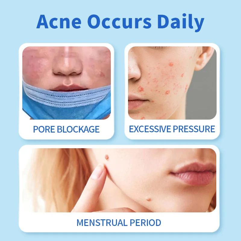 48/120 шт. пластырь от прыщей невидимый дышащий ультратонкий чехол антисвез ремонт