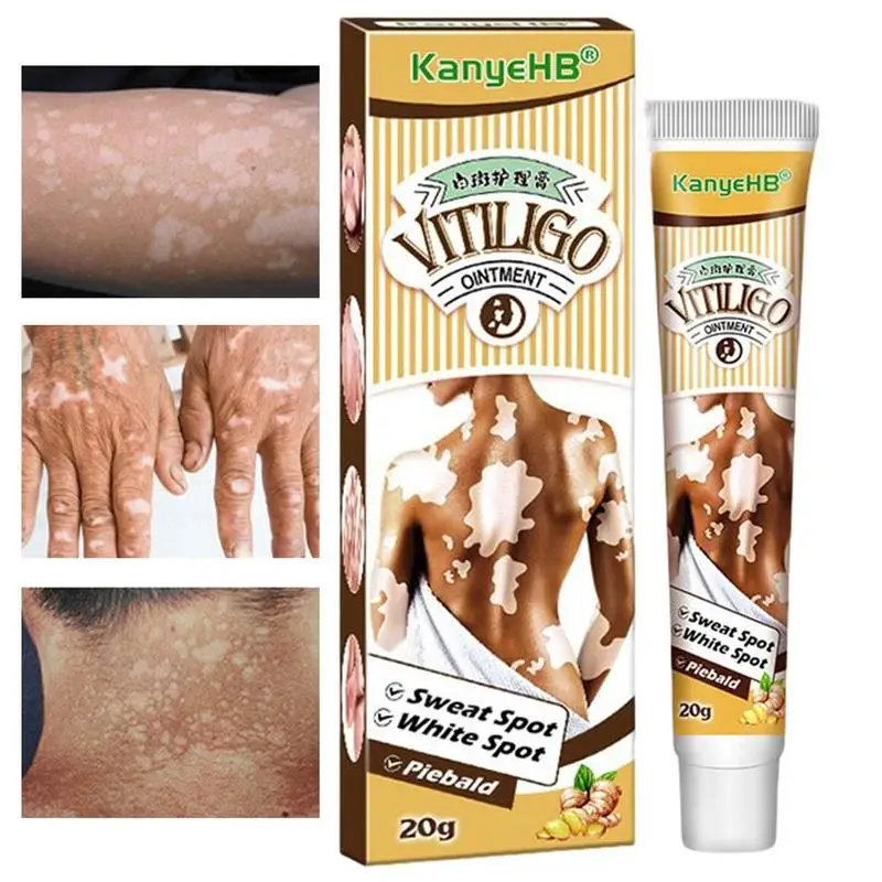 

Отбеливающий крем для кожи, отбеливание кожи, Осветление кожи, декорирование кожи, обесцвечивание, деколорирование, леukoplakia Vitiligo 20 г