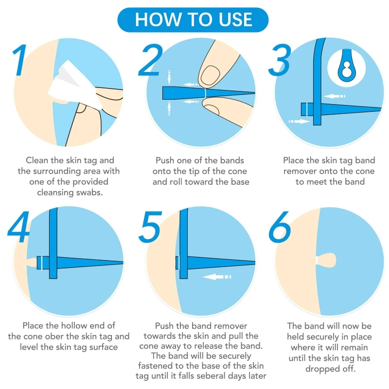 

2 in 1 Skin Tag Remover Skin Tag Removal Kit with Micro and Regular Skin Tag Bands,Safe Remove (1mm-9mm) Sized Drop Shipping