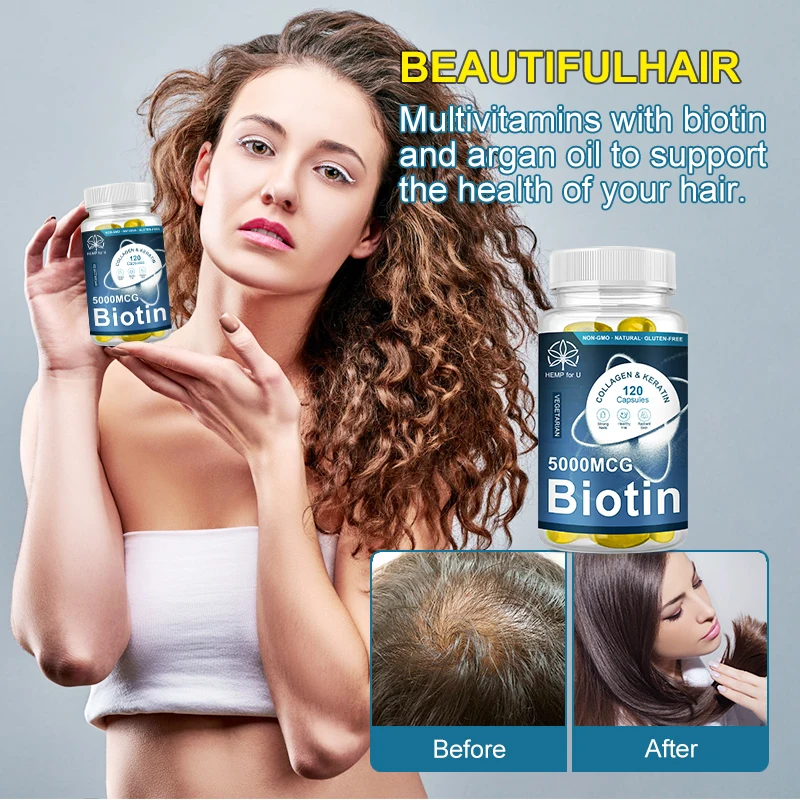 HFU 5000mg Collagen Biotin Essential Oil Capsules Protect the Skin Promote Hair Growth Repair Hair Follicles Prevent Hair Loss